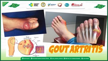Gout Artritis