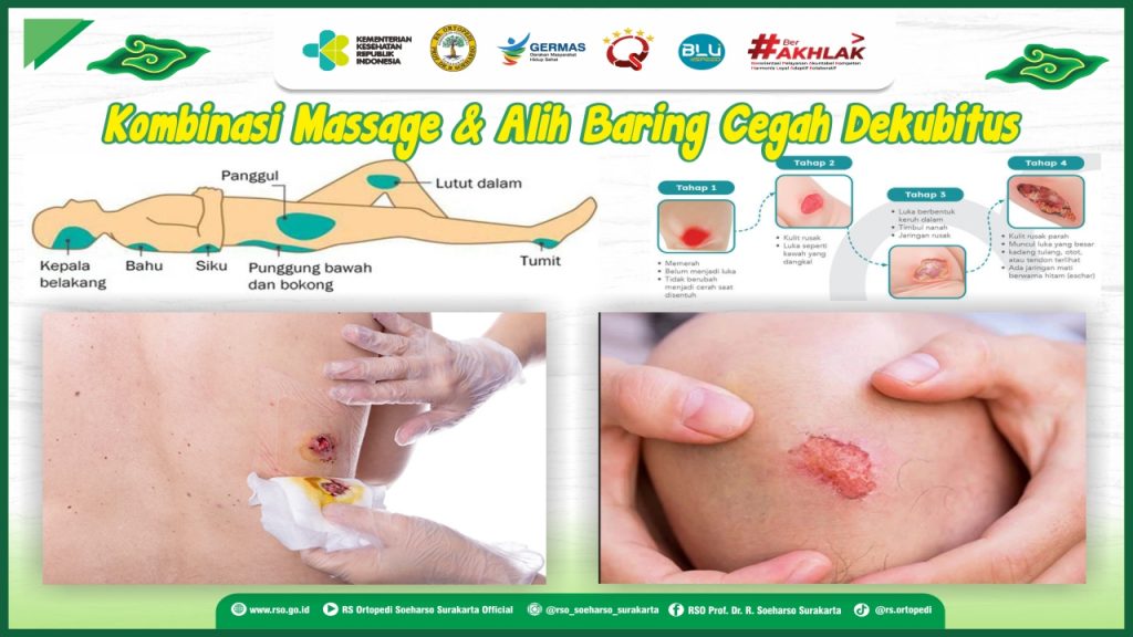 Kombinasi Massage & Alih Baring Cegah Dekubitus