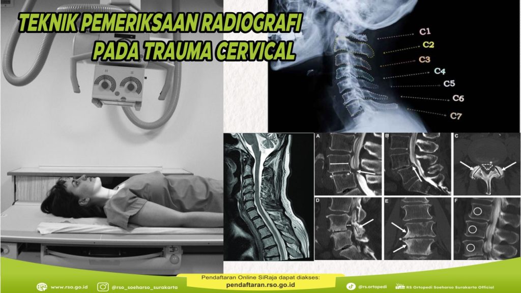 TEKNIK PEMERIKSAAN RADIOGRAFI  PADA TRAUMA CERVICAL
