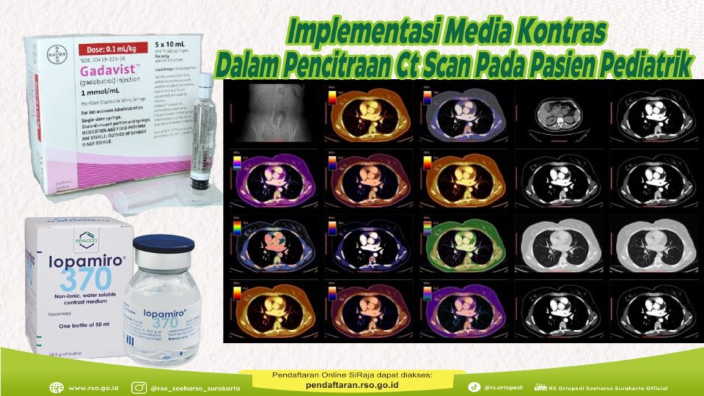 IMPLEMENTASI MEDIA KONTRAS DALAM PENCITRAAN CT SCAN PADA PASIEN PEDIATRIK