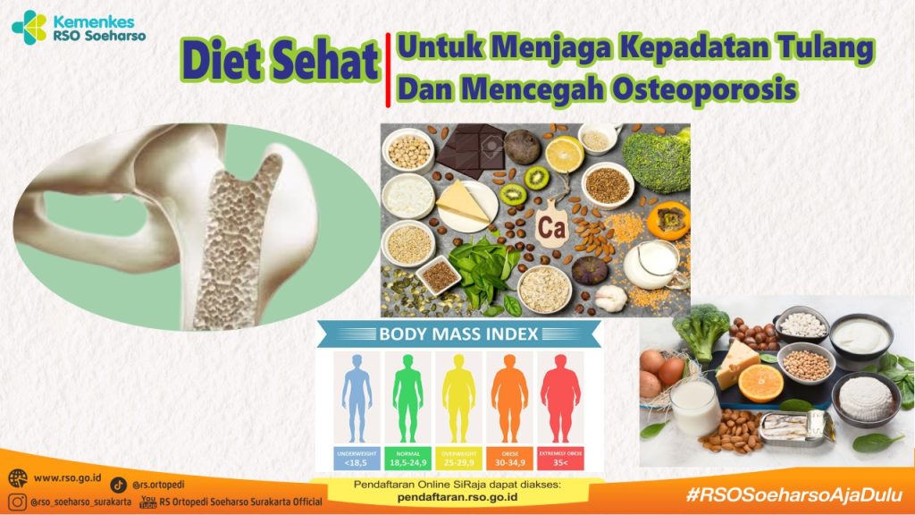 DIET SEHAT UNTUK MENJAGA KEPADATAN TULANG DAN MENCEGAH OSTEOPOROSIS
