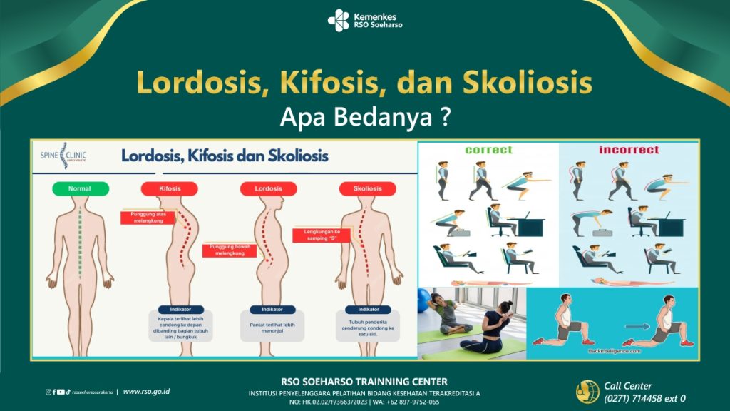 Lordosis, Kifosis, dan Skoliosis, Apa Bedanya ?